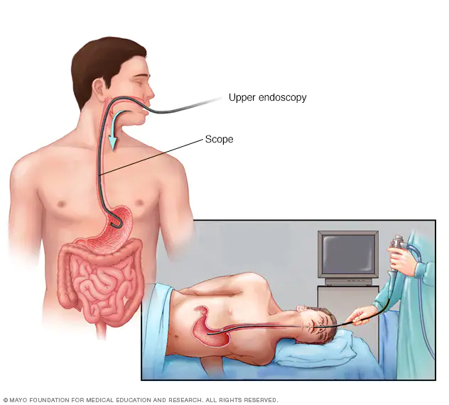 Bagaimana ERCP Meningkatkan Diagnosis dan Pengobatan Gangguan Gastrointestinal?